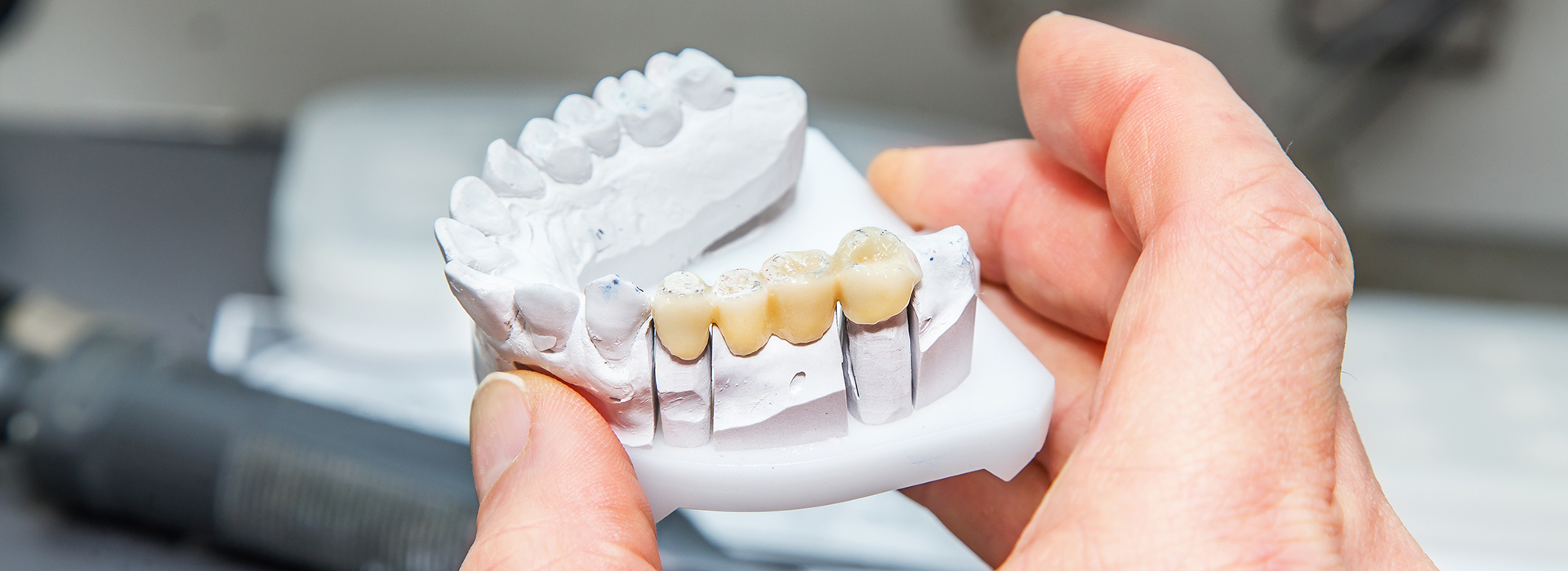 A person s hand holding a white dental model with teeth.