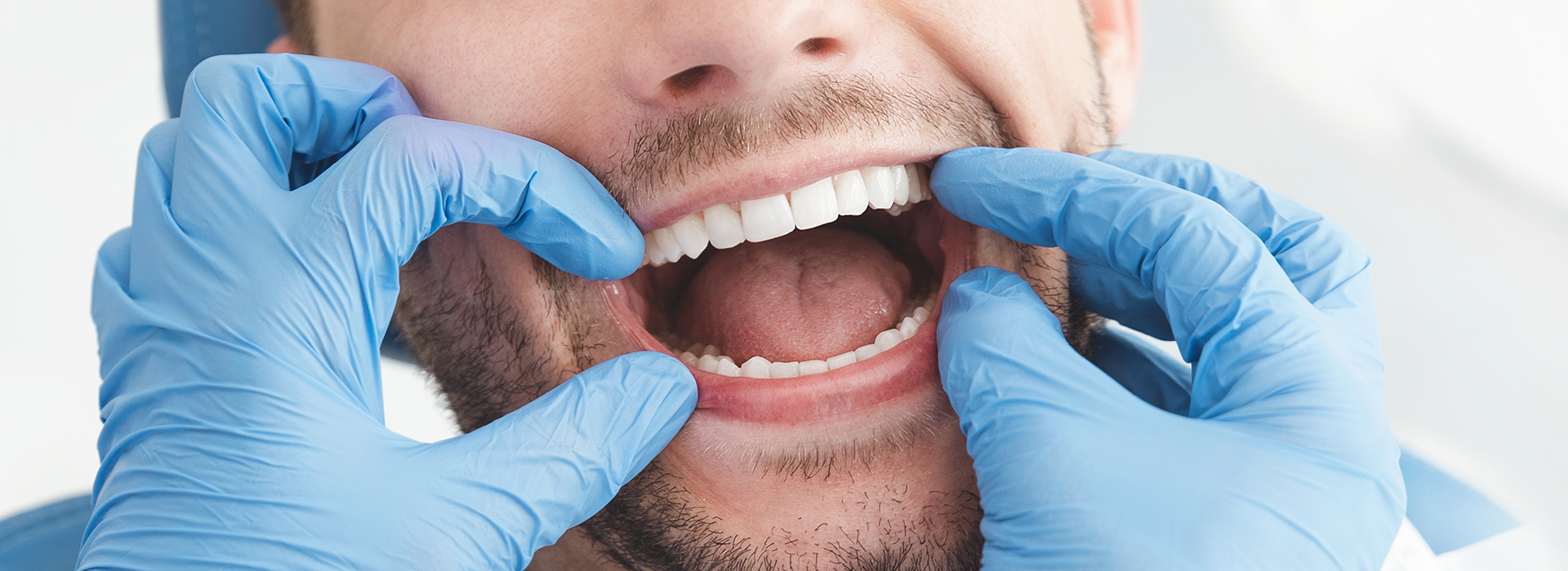 A man with his mouth wide open, receiving dental treatment, wearing blue gloves and a surgical mask.