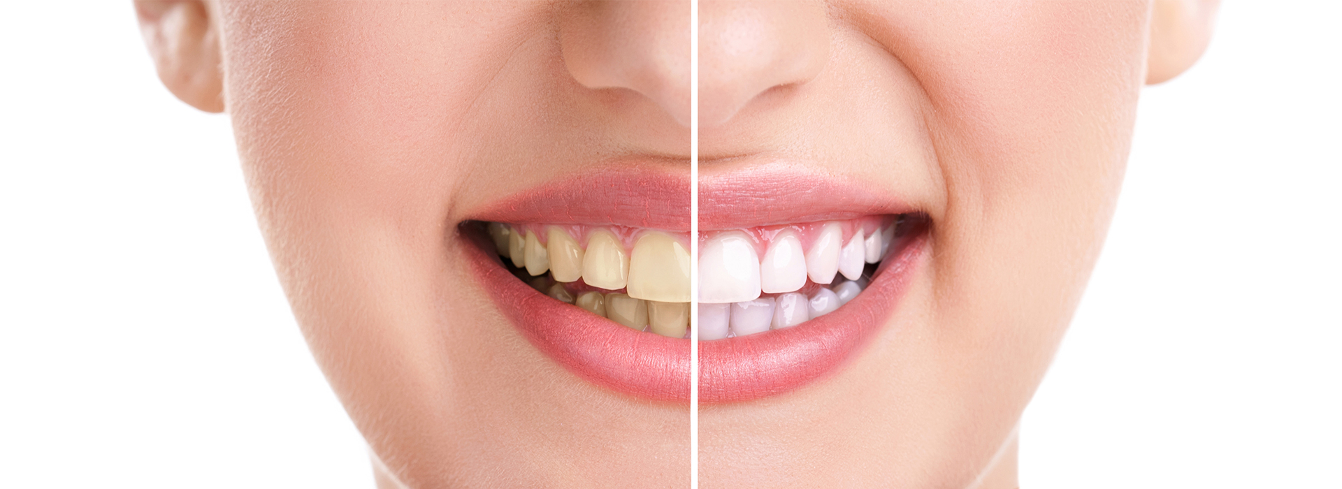 A close-up of a person s face with a focus on the teeth, showcasing dental care or oral health products.